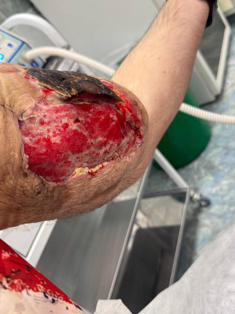 Kirill-Tereshin-Biceps