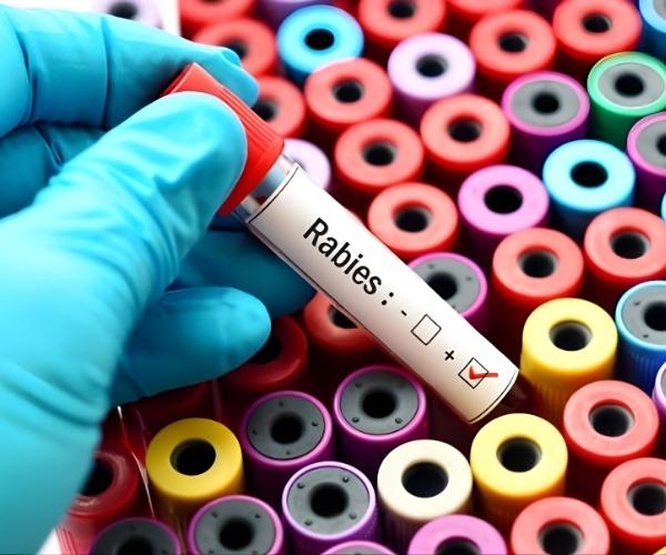 rabies-medical-lab