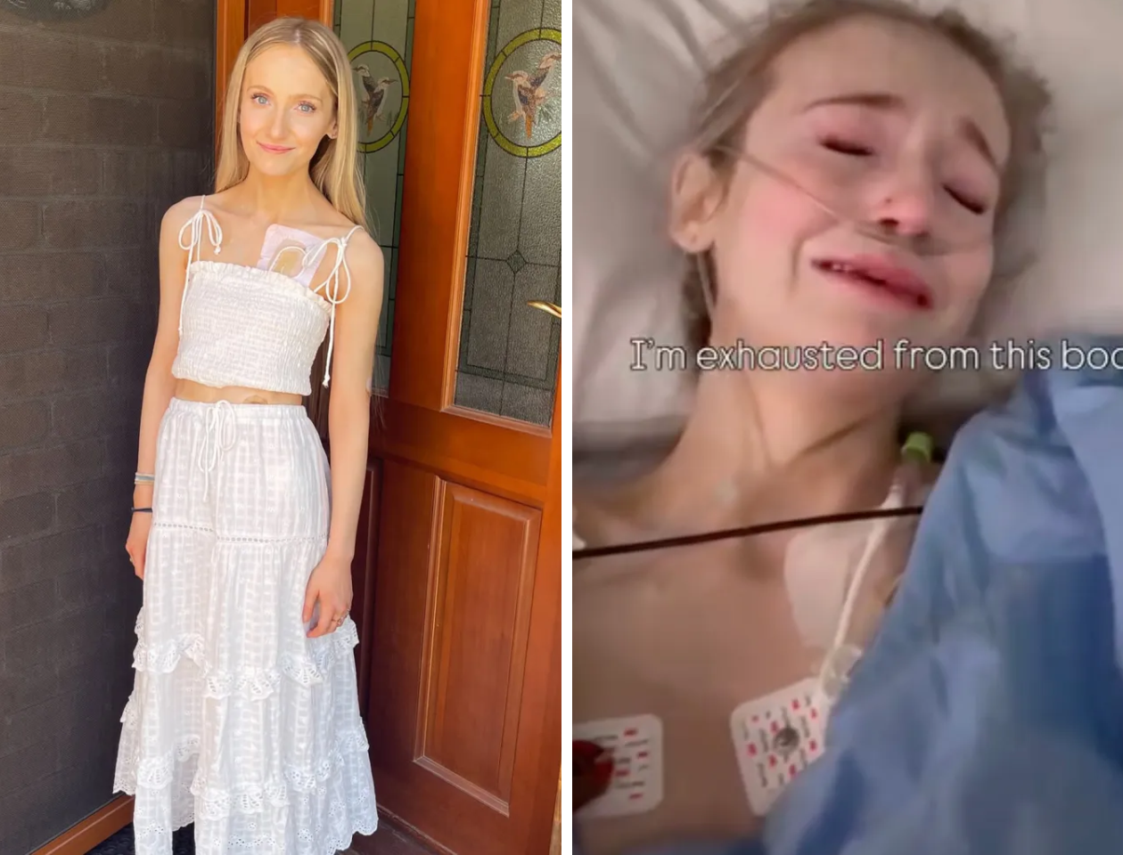 Terminally Ill Australian Woman, 25, Granted Approval for Assisted Dying After Years of Severe Illness