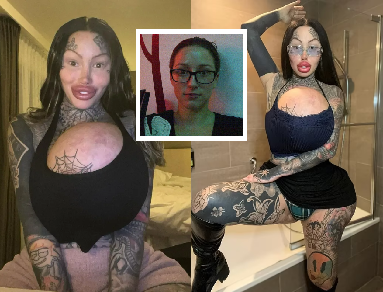 Extreme Surgery Model Mary Magdalene Dies After Plunging From Ninth Floor of Thailand Hotel