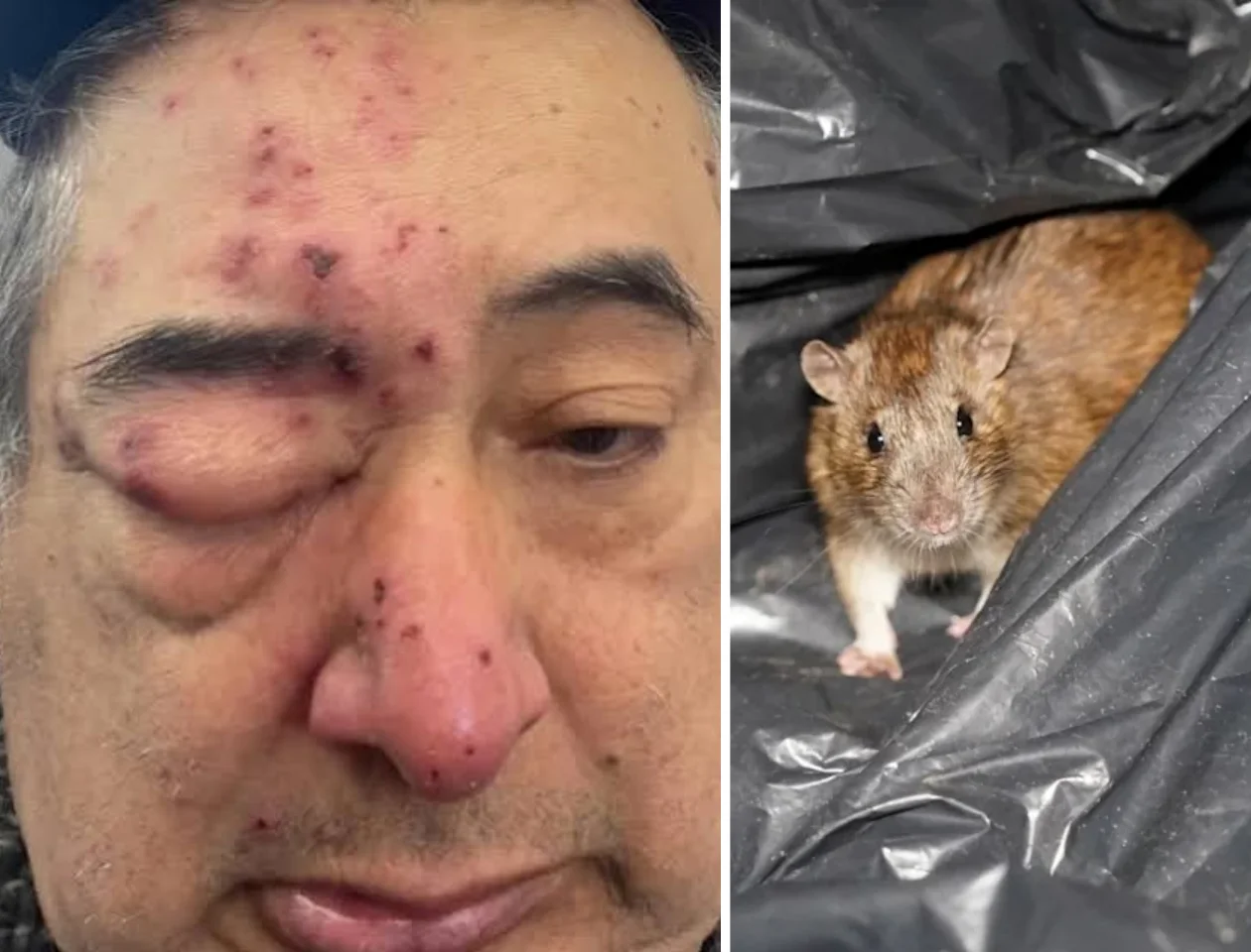 Chicago Tenant Says He Woke Up to a Rat Chewing on His Face After Months of Ignored Complaints