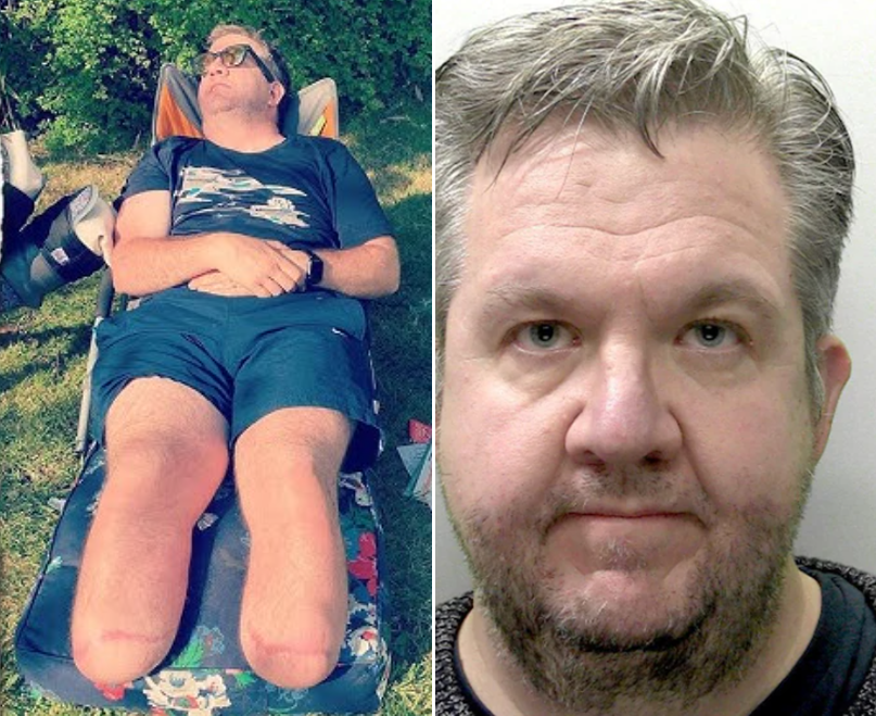 Former NHS Surgeon Jailed After Self-Inflicted Amputations and Fraud